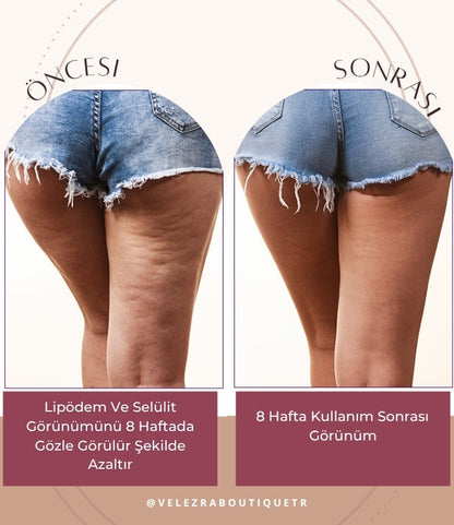 Ezora Şekillendirici Toparlayıcı Selülit Giderici Şort Korse